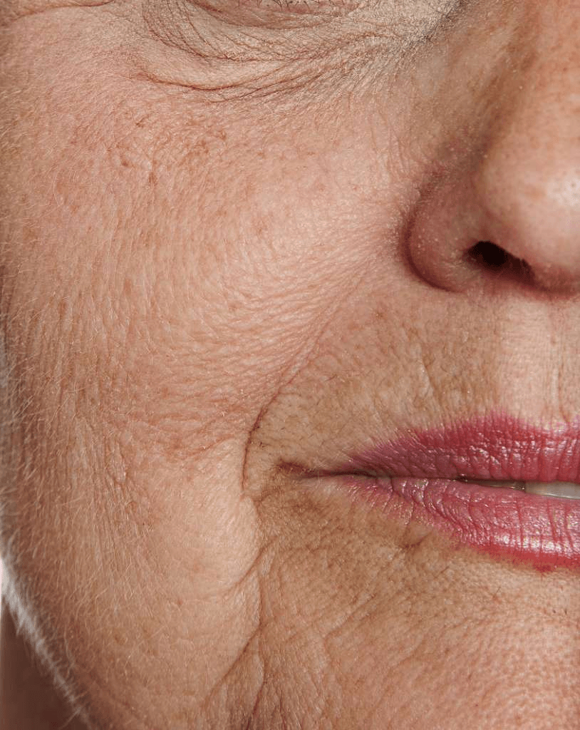 Anti-Aging image 2