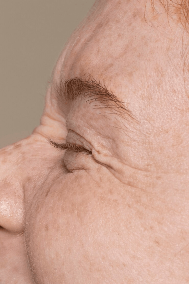 Anti-Aging main image