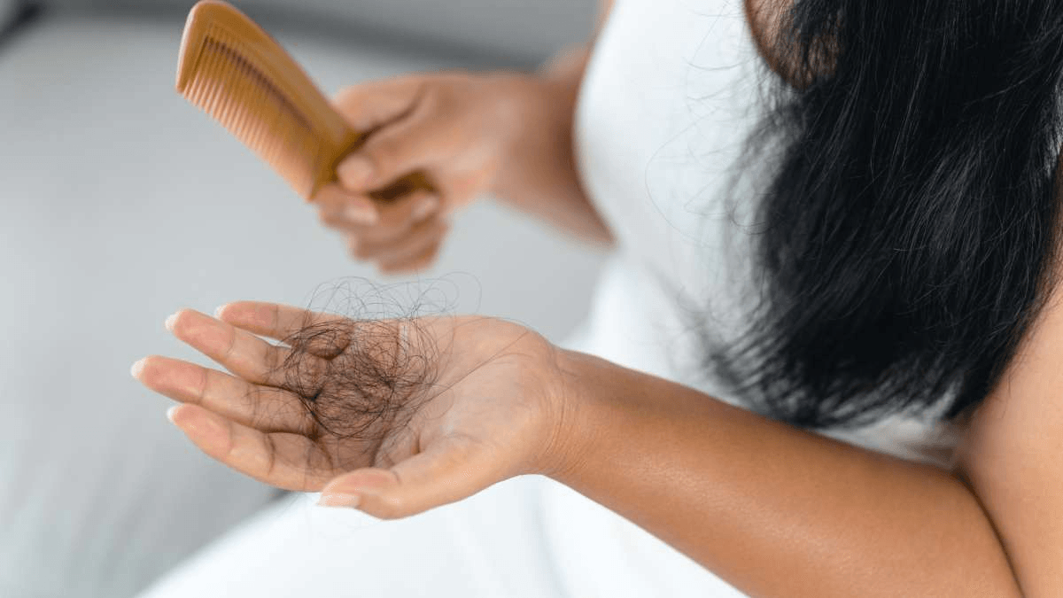 Hair Loss image 3
