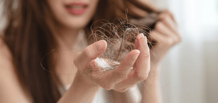 Hair Loss image 2