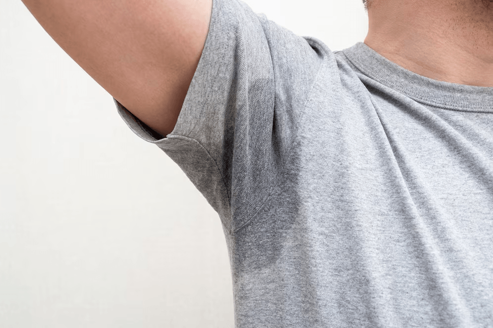 Hyperhidrosis main image