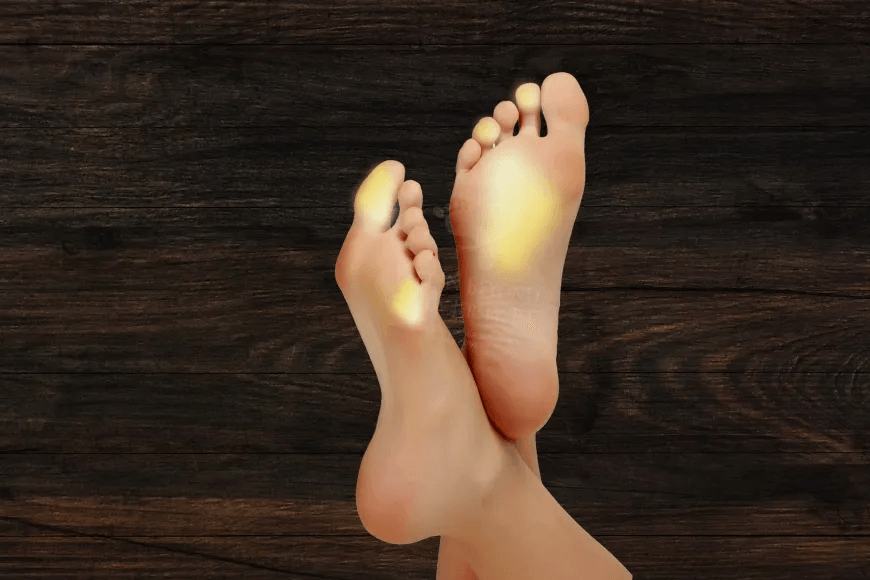 Raynaud’s image 2