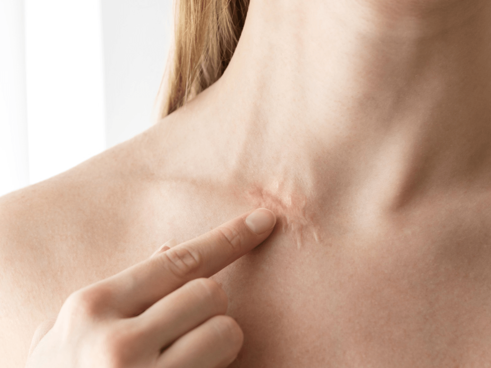 Scars image 2