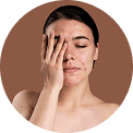 skin condition image