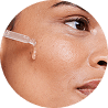 skin condition image