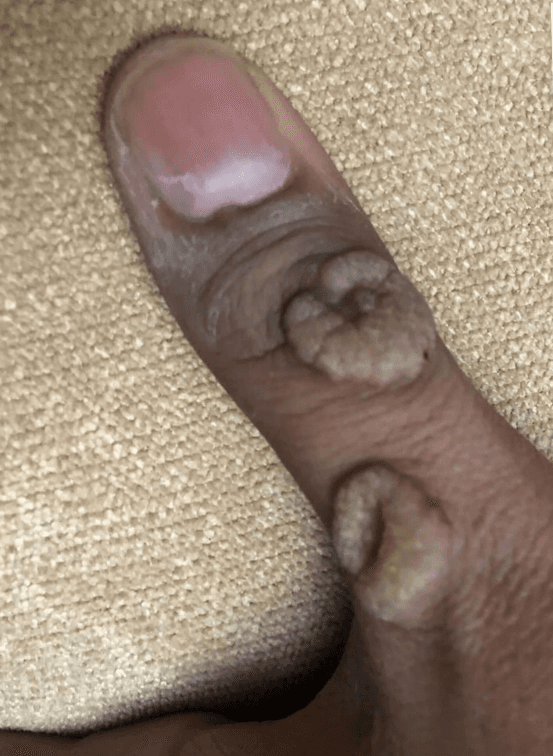 before treatment