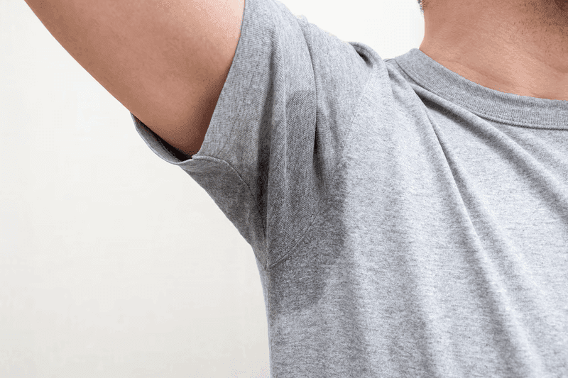 hyperhidrosis condition image