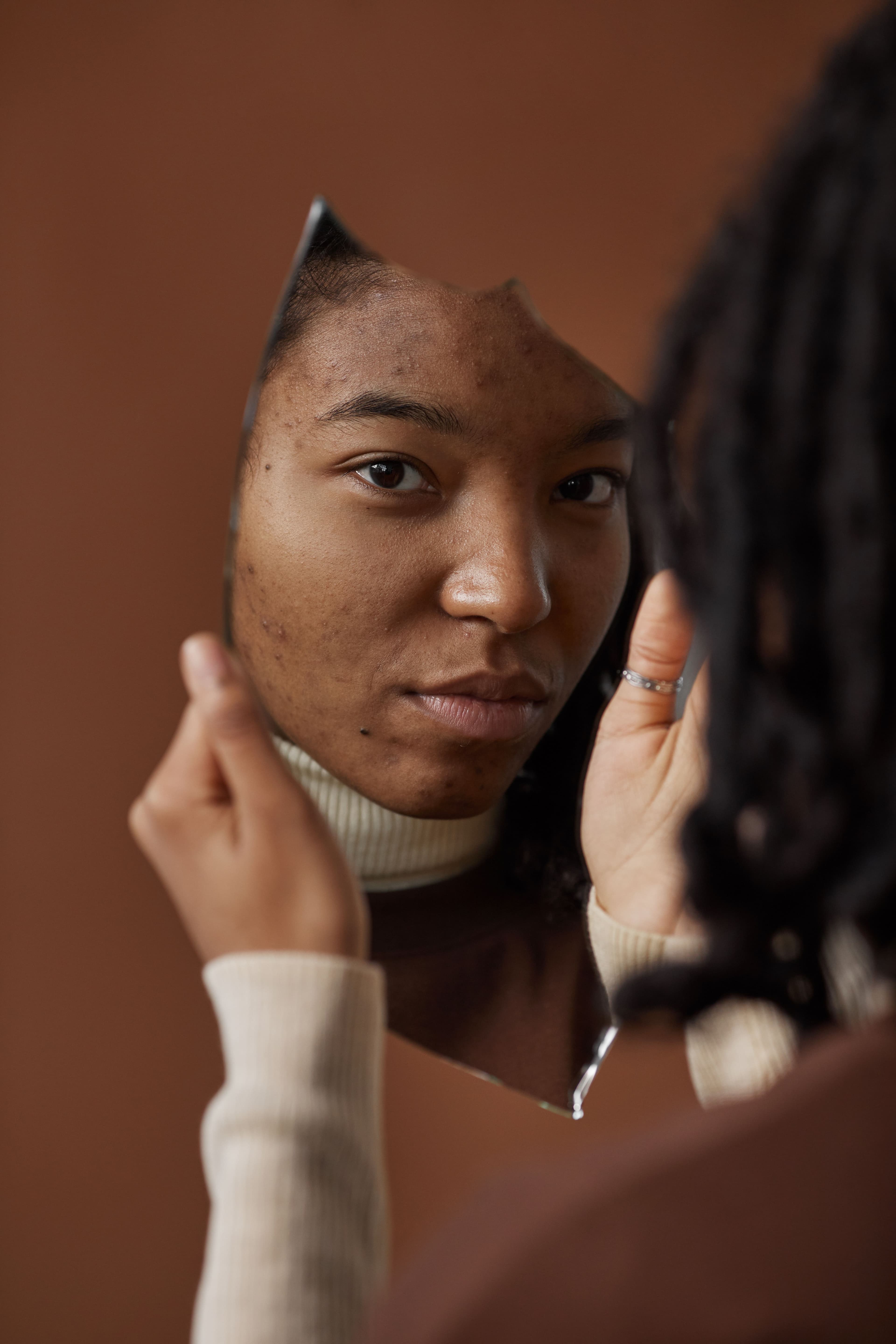 Woman with acne looking at herself on broken mirror.