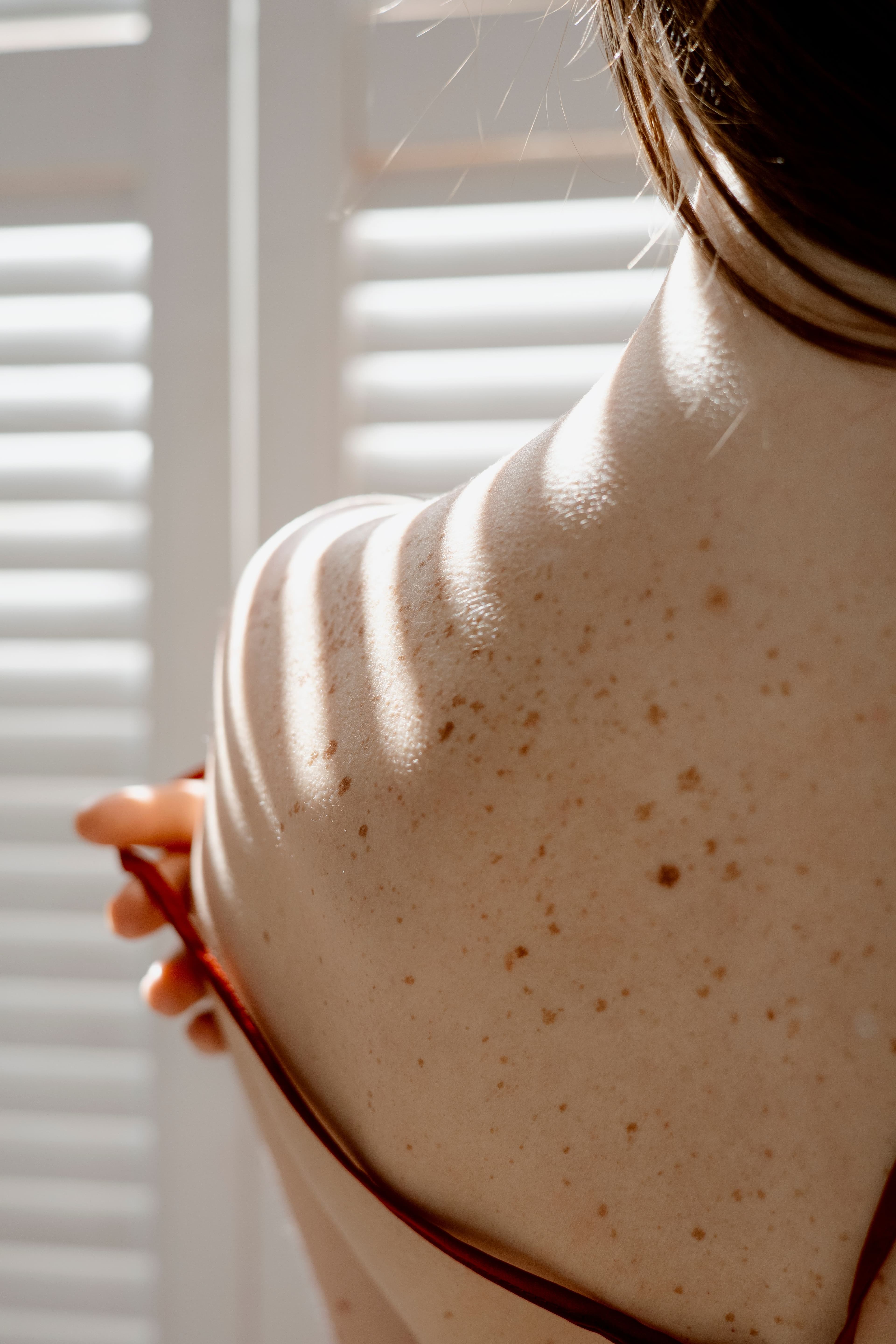 Woman's back with freckles and moles.