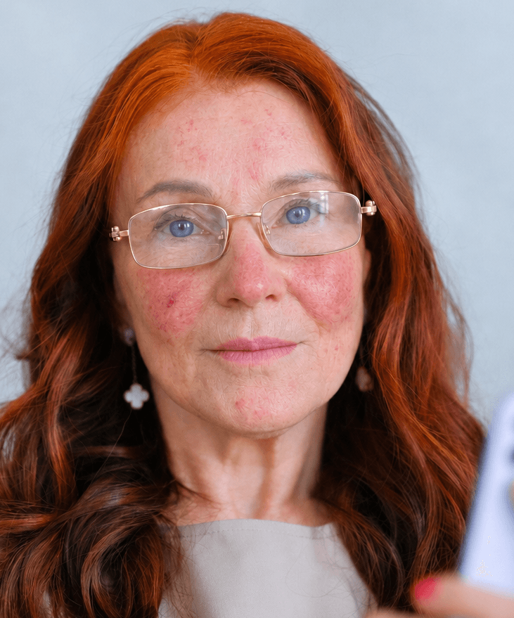 Woman with red hair, glasses, and blue eyes looking at the camera.