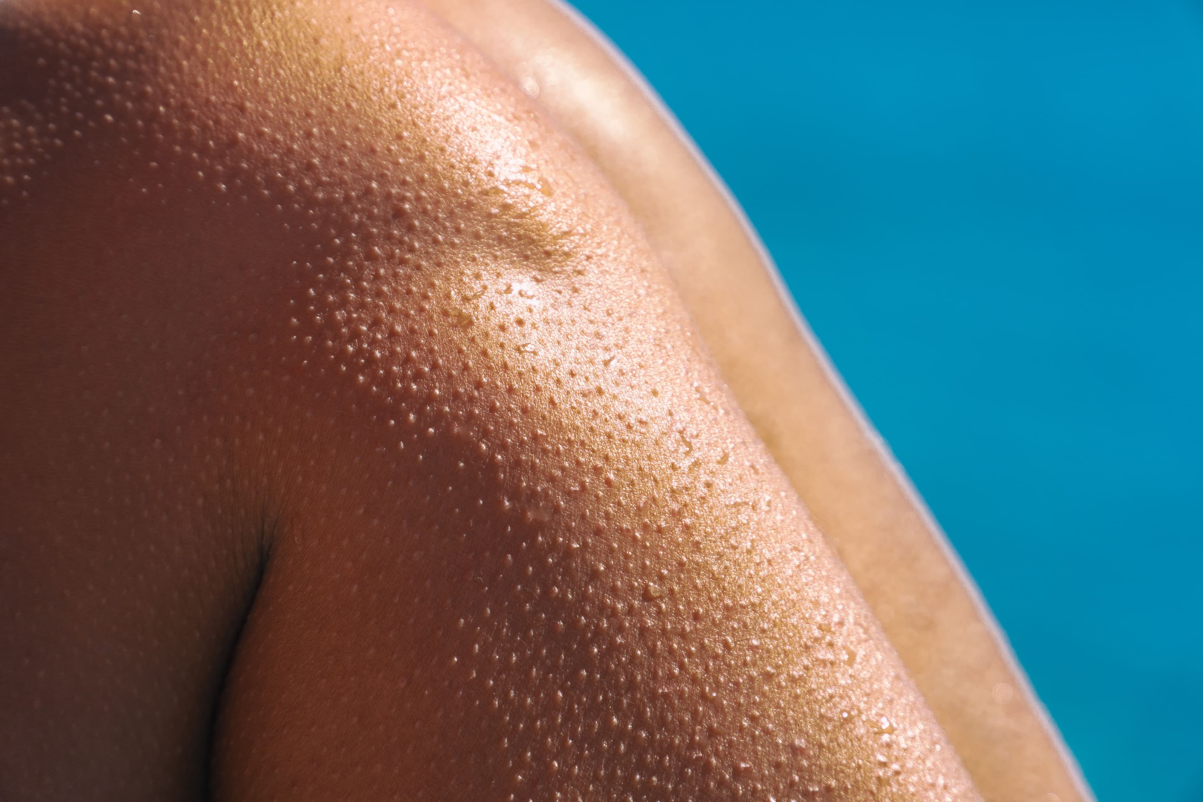 Legs with bumps.