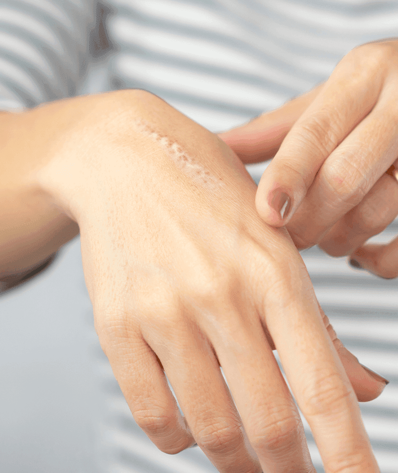 scars condition image